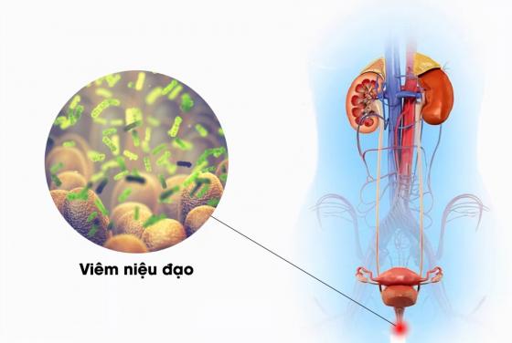 1729394280486871.jpg bJNzXV2u-viem-nieu-dao-1.jpg