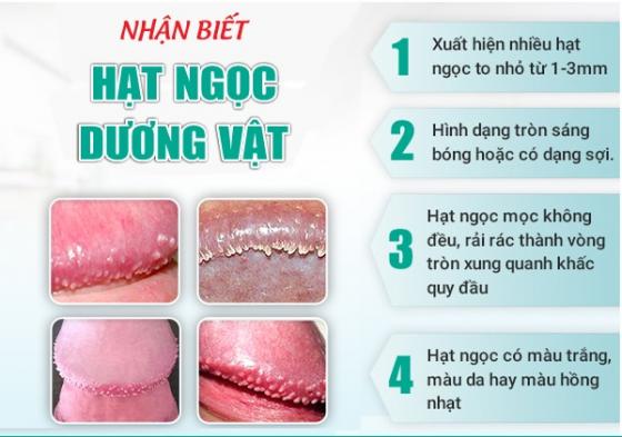 1759463340368178.jpg hat-ngoc-dv.jpg