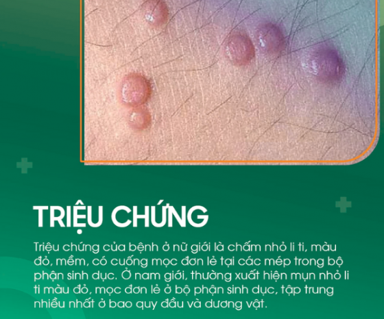 1759558982264767.png pk-binh-duong (7).png