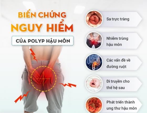 1760517404654442.jpg poly-hau-mon-bien-chung.jpg