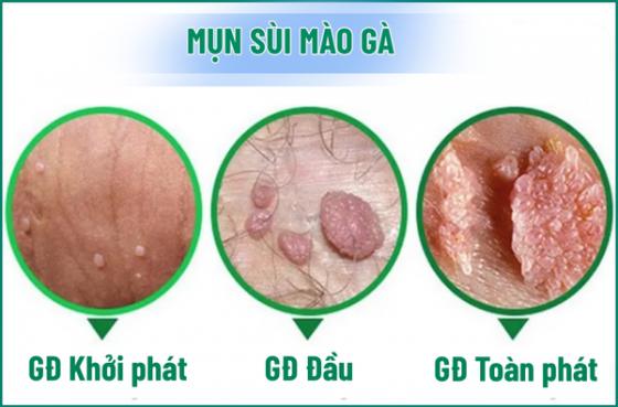1761105462755834.png chua-benh-hieu-qua (85).png