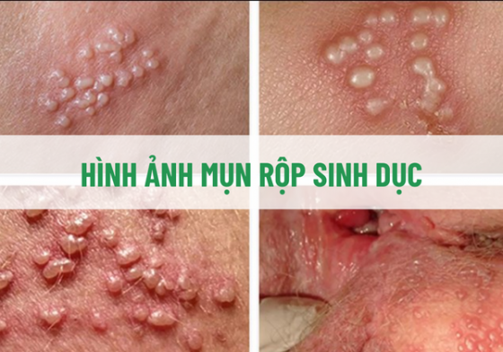 1761550015745314.png chua-benh-hieu-qua (64).png