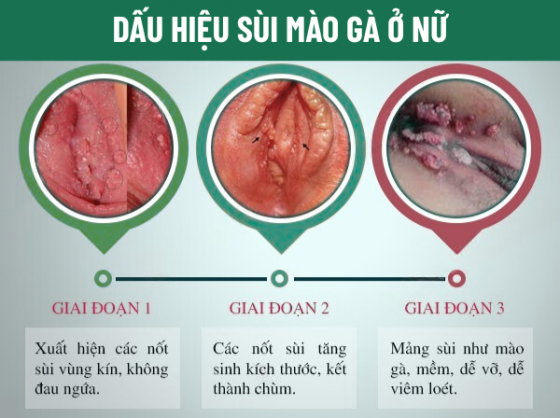 1761550052327982.png pk-binh-duong (9).png