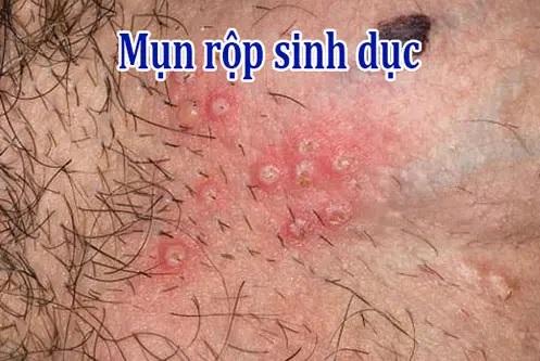 1761556577381680.jpg mun-rop.jpg