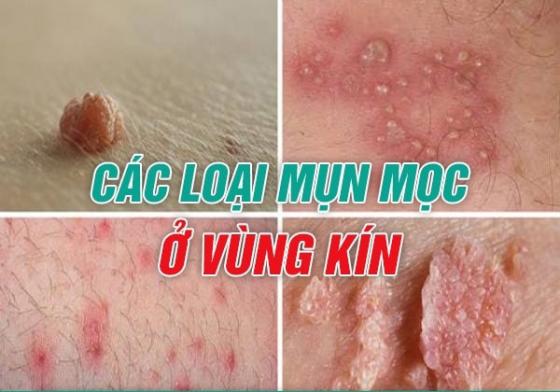 1761556656625681.jpg mun-vung-kin.jpg
