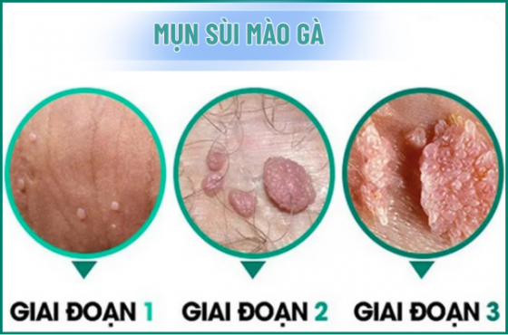 1761557017899958.png chua-benh-hieu-qua (34).png