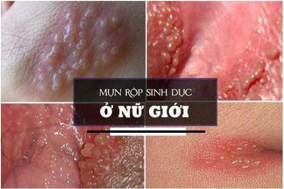 1761643539899607.jpg mun-rop-3.jpg