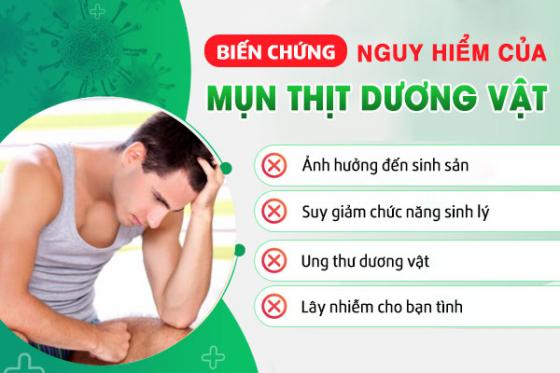 1774408971275757.jpg mun-thit-duong-vat.jpg