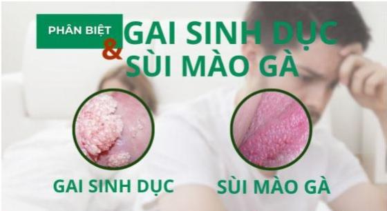 gai-sinh-duc.jpg